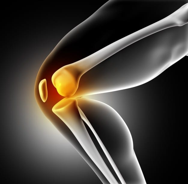 Patella Femoral Joint Pain